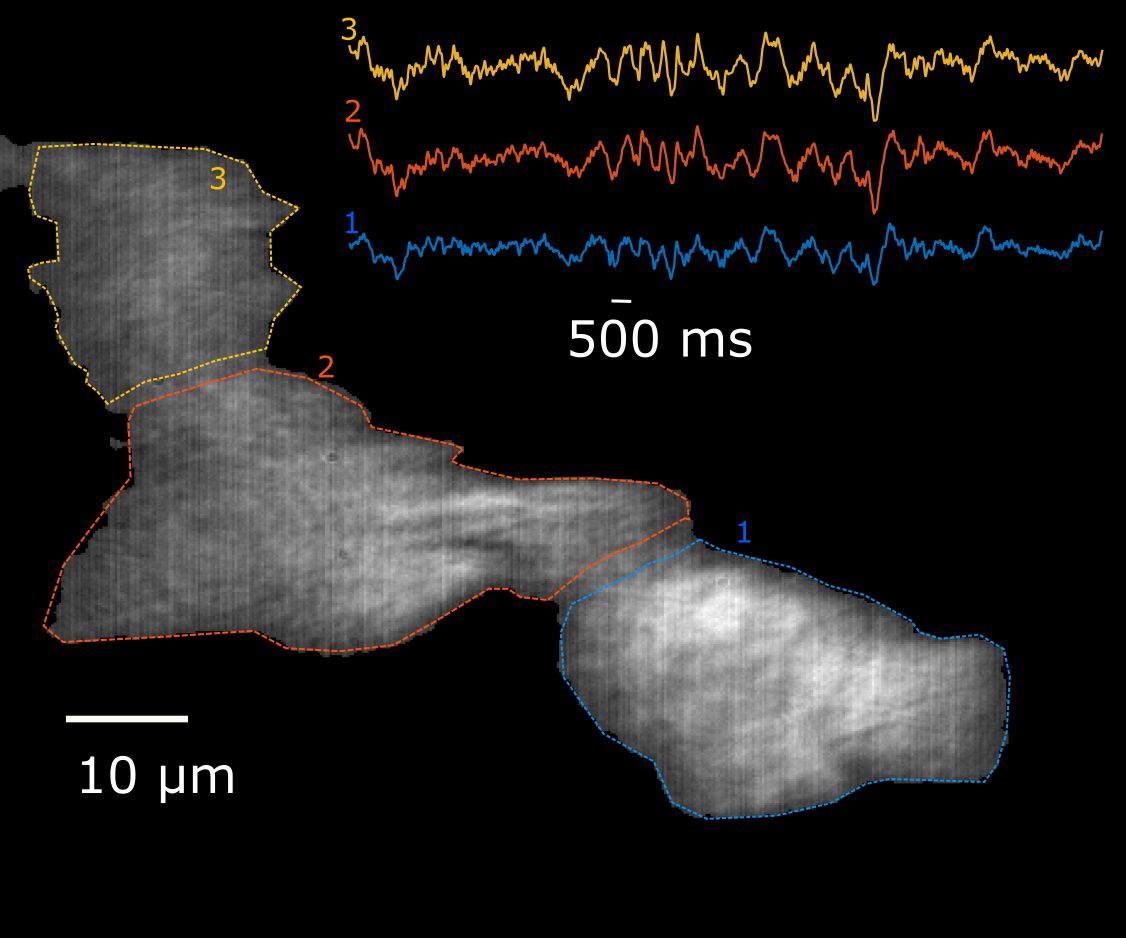Plasmonic imaging of living pancreatic beta-cell networks showing bioelectrical oscillations