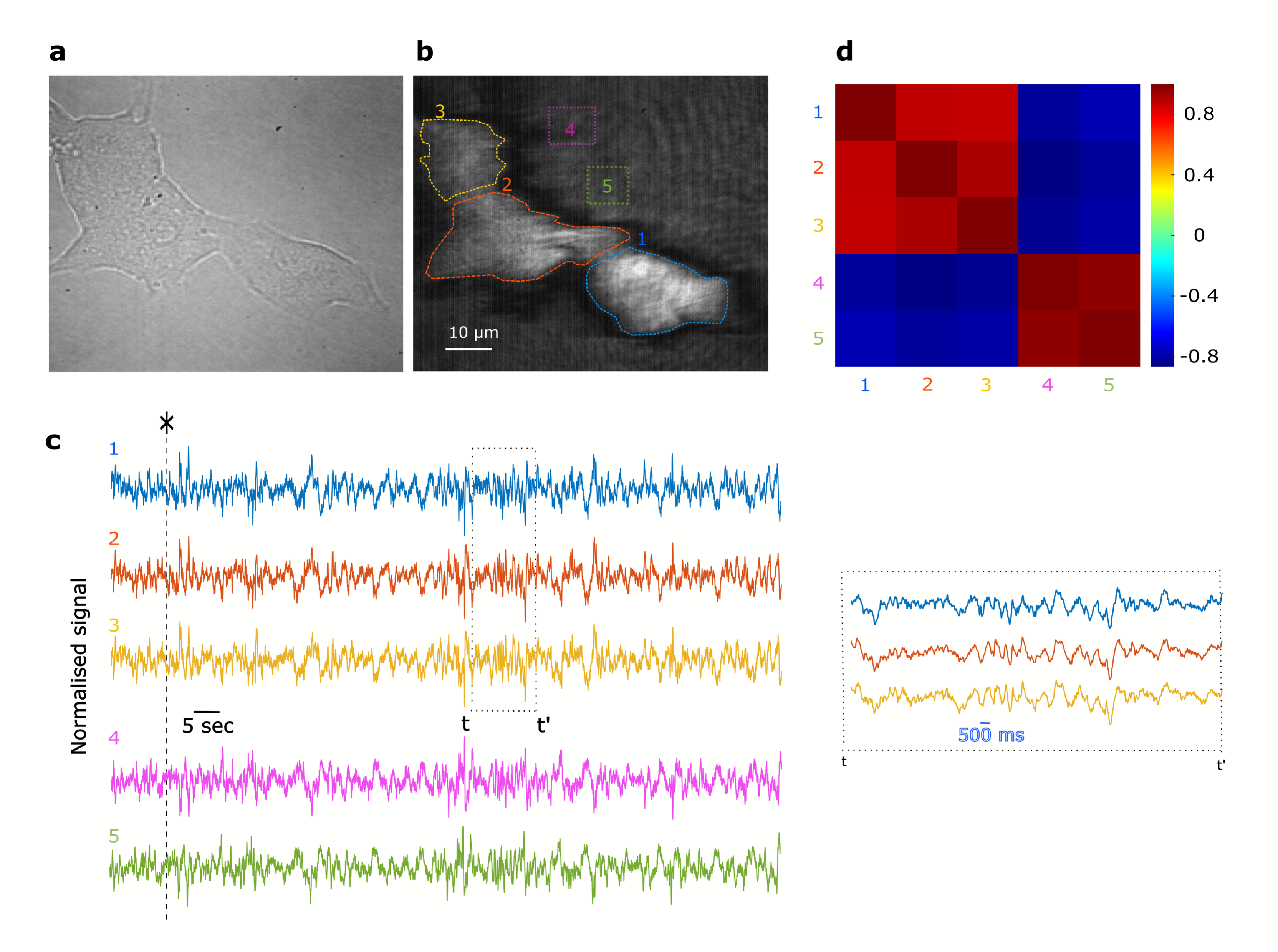 Label-free imaging of beta cell networks